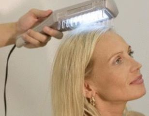 fotografia liečby psoriázy na hlave